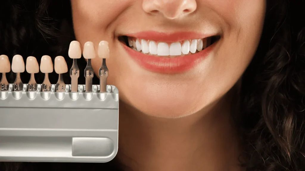 woman smiling with set of veneers bradstowe dental practice