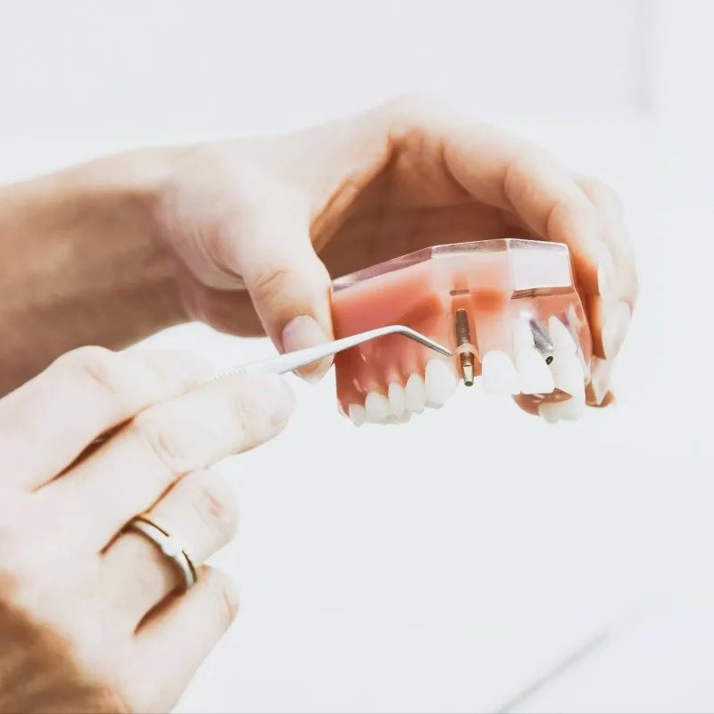 Dental Implants Cost in Woking