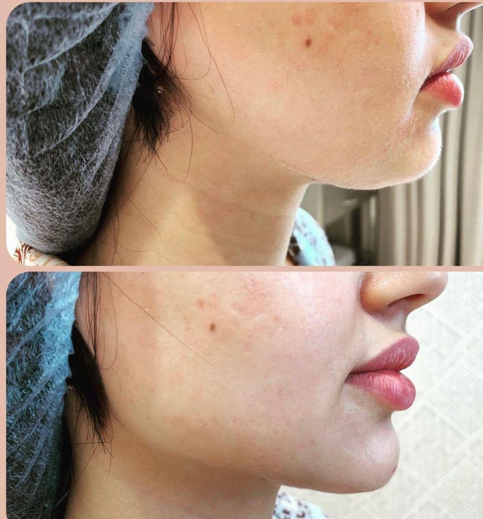 facial-aesthetics-before-after (1)