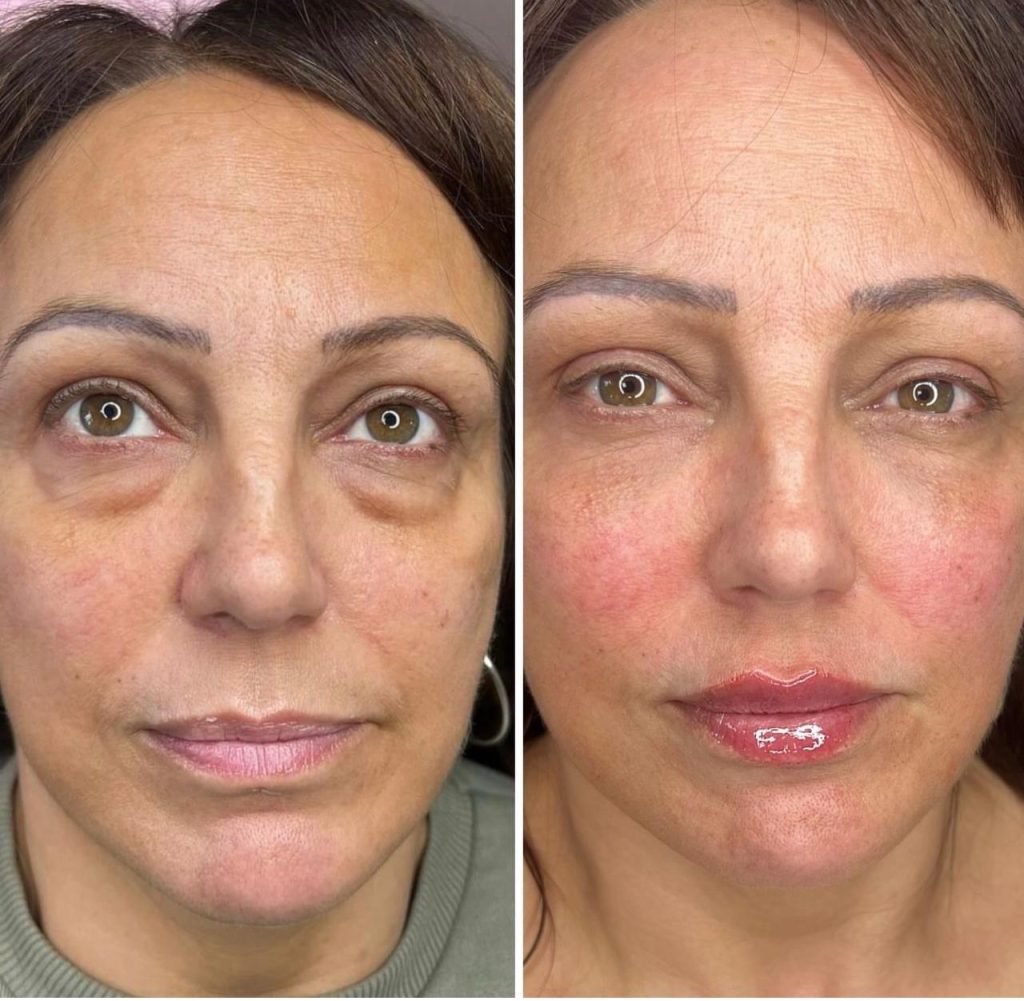 facial-aesthetics-before-after (2)