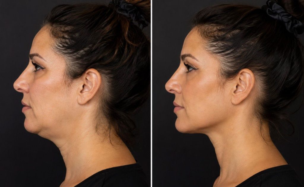 facial-aesthetics-before-after (5)