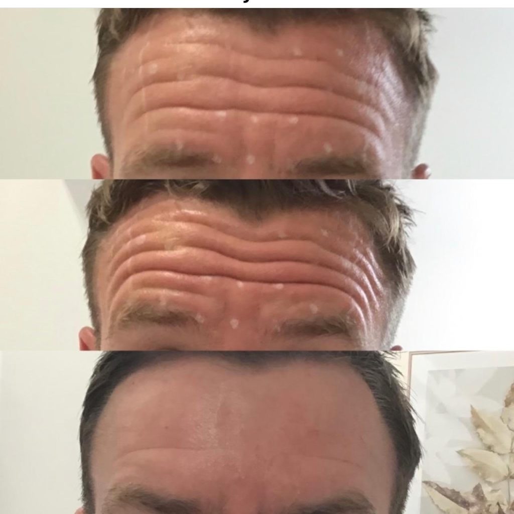 facial-aesthetics-before-after (6)