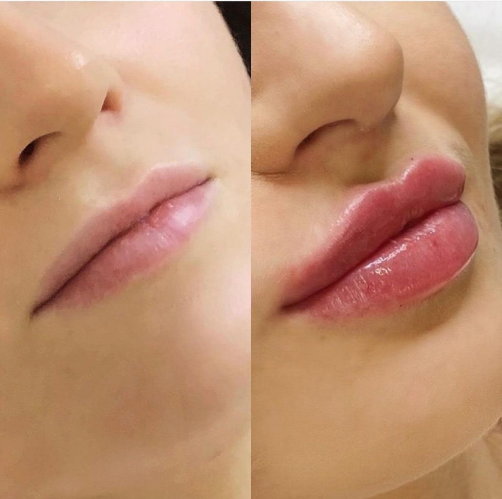 facial-aesthetics-before-after (7)