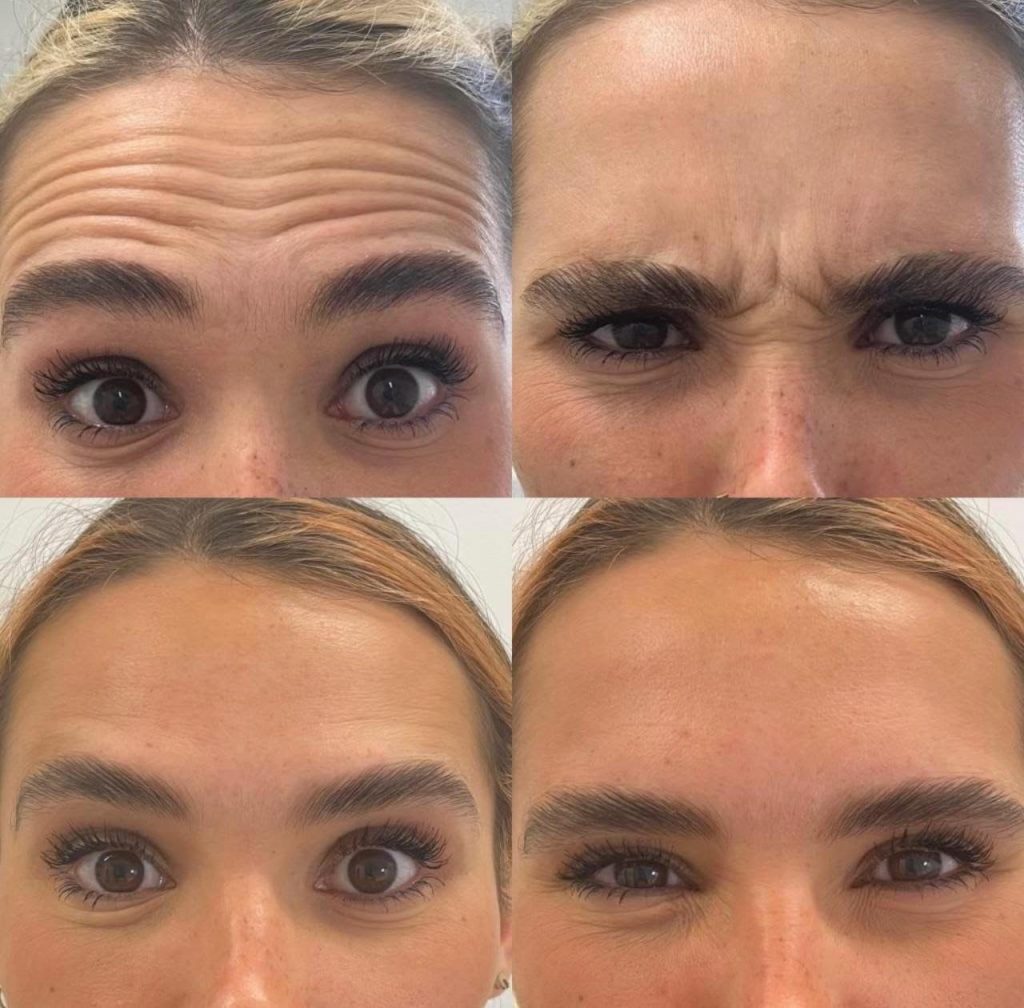 facial-aesthetics-before-after (9)