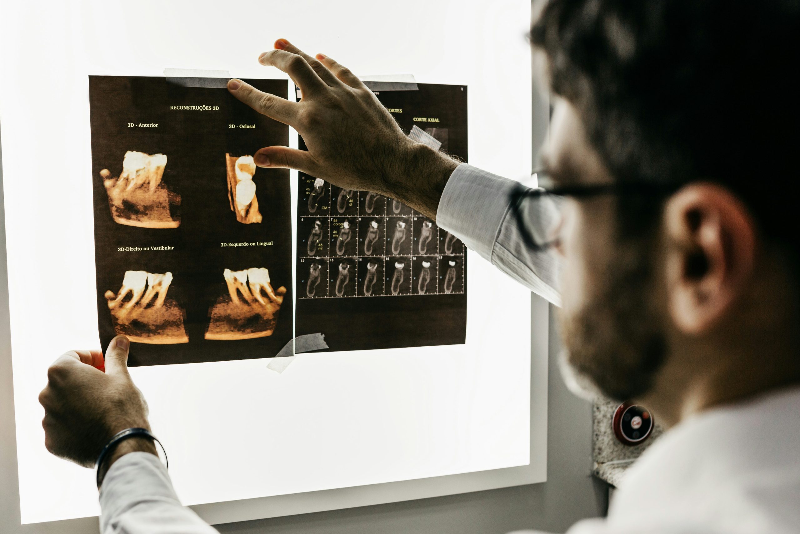 Dental clinician reviewing 3D jaw and implant scans on a screen during All-on-4 treatment planning at Bradstowe Dental, Woking